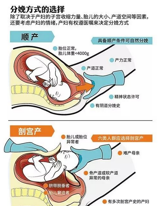 无痛分娩真的不痛吗？