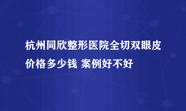 杭州同欣整形医院全切双眼皮价格多少钱 案例好不好