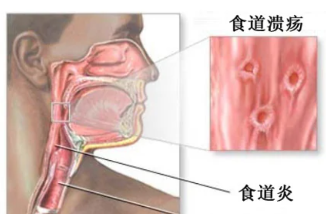 苏州凌阿九死了？