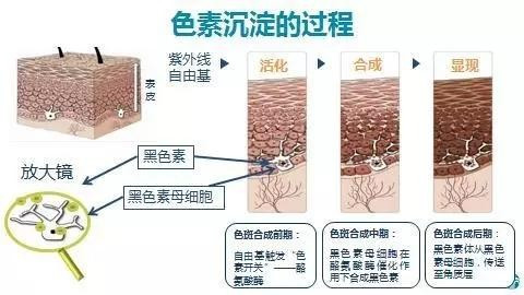 最好的祛斑美白方法?