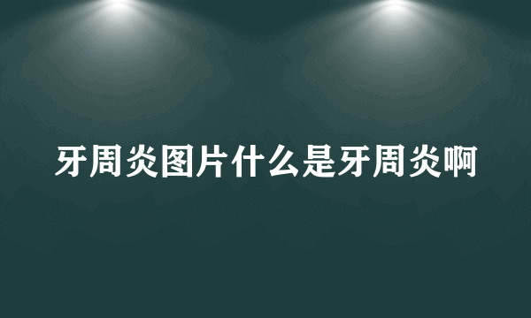 牙周炎图片什么是牙周炎啊